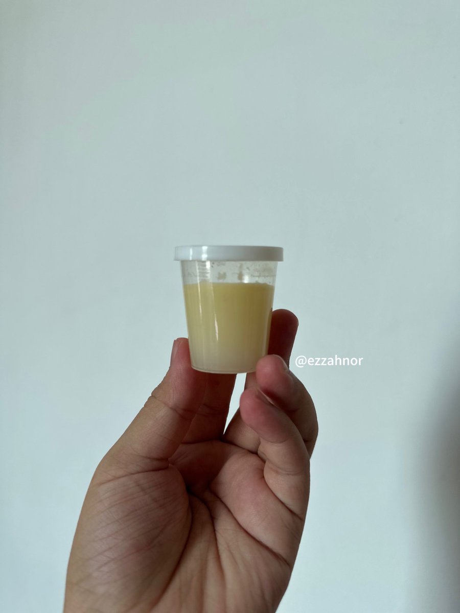 Ibu yg bakal bersalin, please prepare colostrum harvesting kit ni.

Baby i warded 4 hari lepas lahir. Nasib baik i ada colostrum harvesting kit ni.

I dapat simpan liquid gold ni utk baby 😭🫶🏻