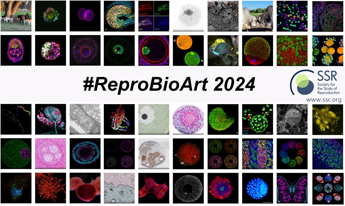 #ReproBioArt Contest is waiting for your votes! See details here ssr.org/reprobioart-co… Learn more about reproductive research and admire the work of scientists related to  #Infertility and #Reproductive_health woobox.com/kbxnvj. Share with your friends and colleagues!