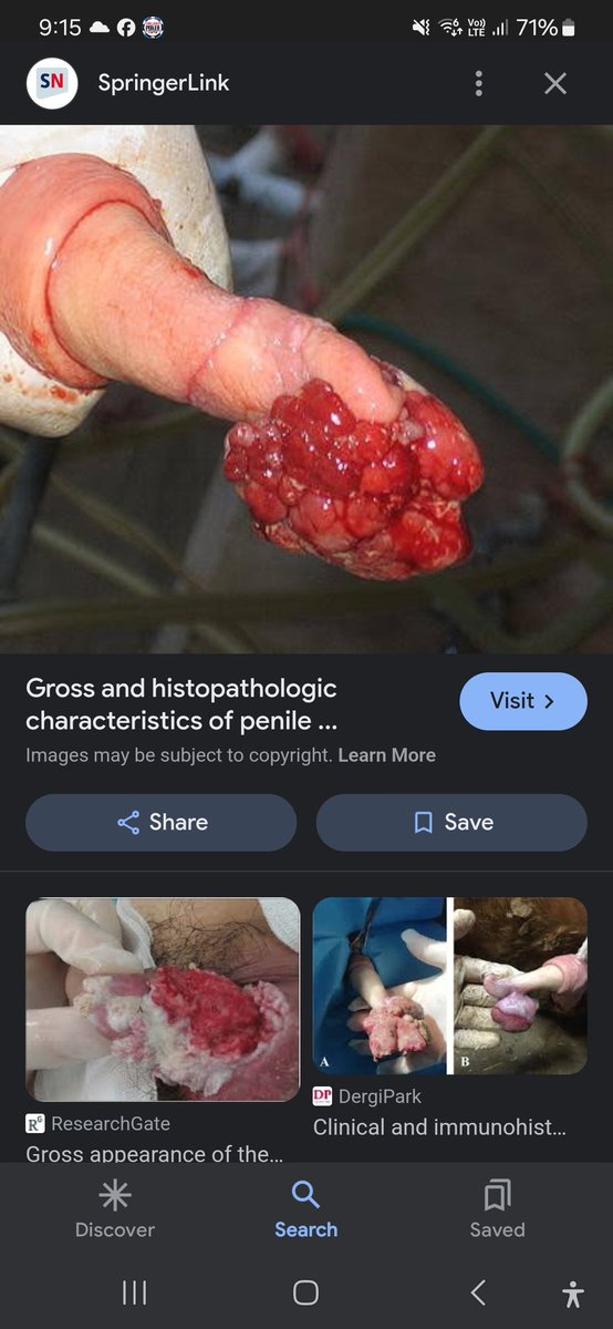 Angus1322131's tweet photo. Another post to not let @Grace71878769 breath I have just received info that in fact she is not a girl and has a penis and it probably looks like this , now this is the disease that she got from going down on a fishy chinese woman https://t.co/P9fBXuL0h2
