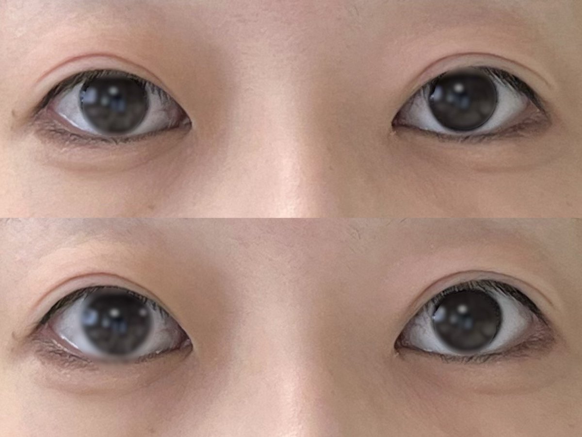 ptiptiman's tweet photo. ↑力入れてない目
↓力入れた目

もう良くね？の気持ちと自分がなりたかった二重ってこれだった？いいん？って気持ち🥺🥺🥺 https://t.co/bKJctI1Hzn