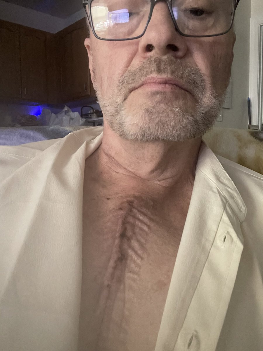 Well open heart surgery, not was I was expecting.