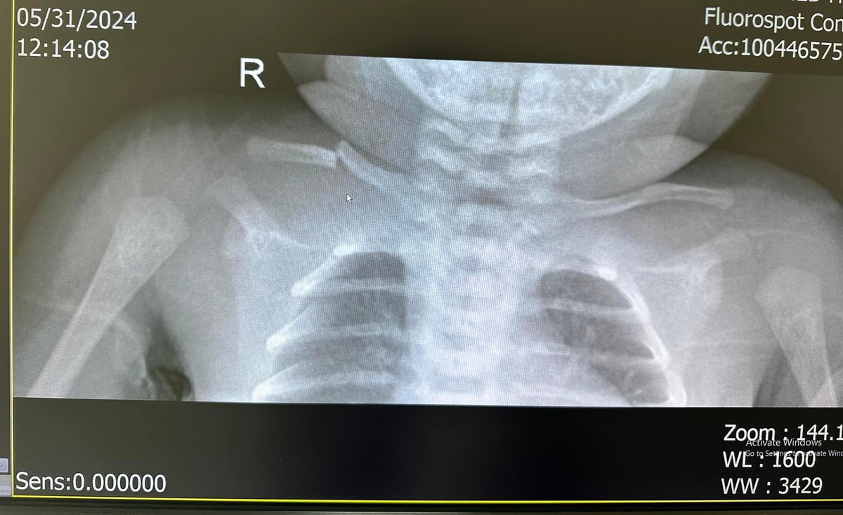 📌Иргэний пост:😱😱😱

Интермед Эмнэлэг
Арайчдээ хариуцлага ёс суртахуун гэж юм байна уу? Танай эмнэлэг Монгол улсад байгаа хамгийн үнэтэй эмнэлэг биздээ?  Тэрийгээ дагаад хариуцлага гэж байх ёстой биздээ! Илүүдээ гарсан мөнгөтэйдөө биш та нарт итгэсэндээ шүү! Танайхыг арай