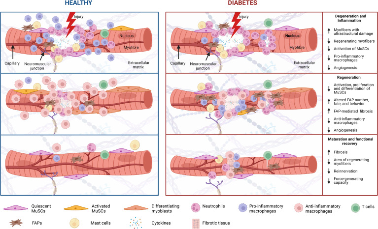 Impaired skeletal muscle regeneration in diabetes: From cellular and molecular mechanisms to novel treatments dlvr.it/T7qR29