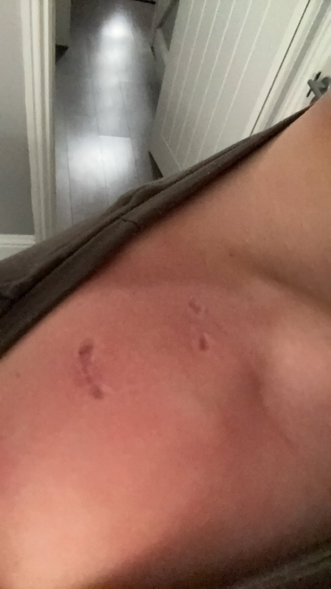 jhilt90's tweet image. Bring back #Smacking