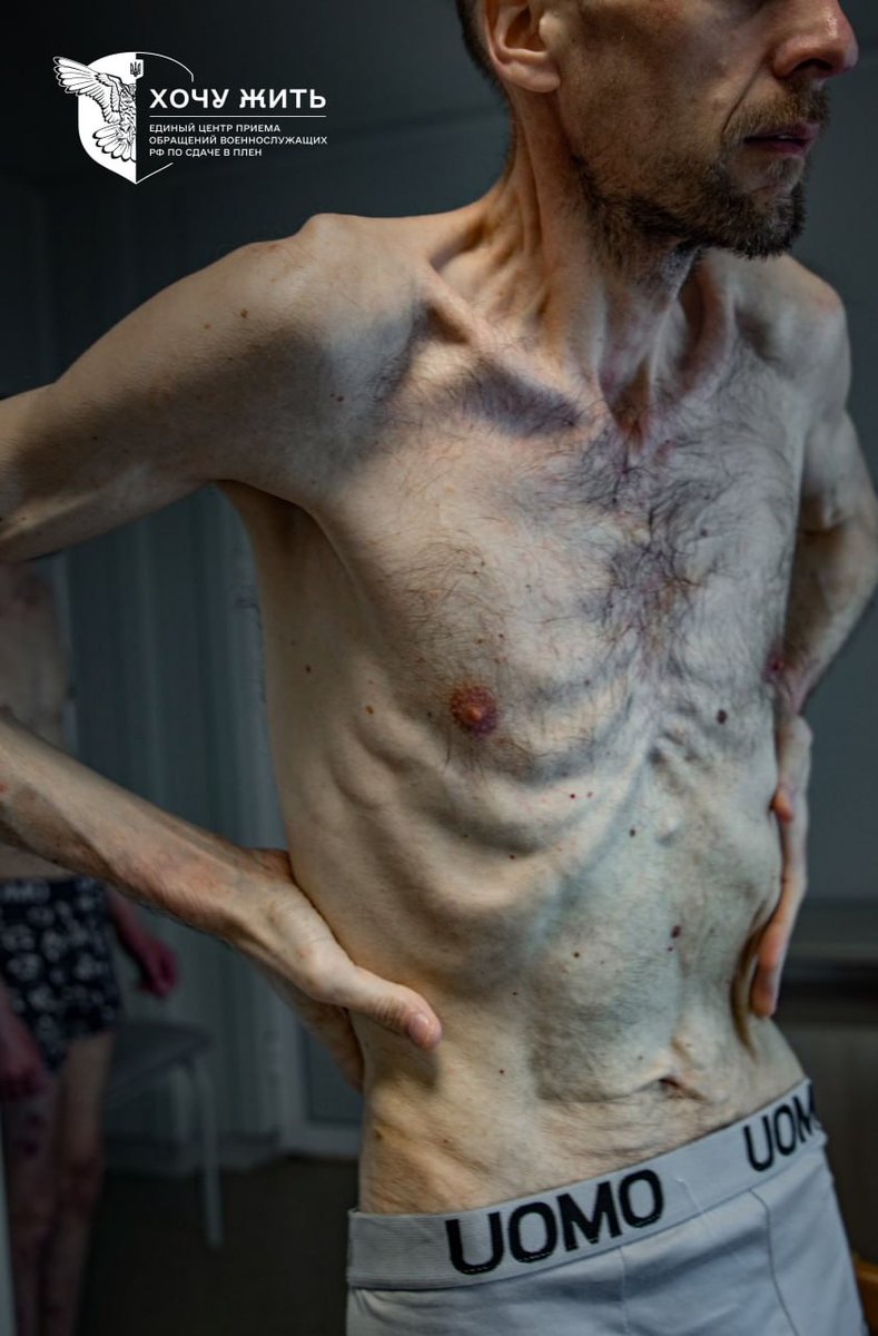Gerashchenko_en's tweet photo. This is Roman Horilyk, a member of Ukrainian National Guard, after two years in Russian captivity. 

Roman was the senior controller of the checkpoint of Chornobyl nuclear power plant. Russians took him and the other 168 National Guardsmen hostage when they occupied the plant in 2022. 89 of these Guardsmen are still in Russian captivity.

📸: @hochuzhit_com