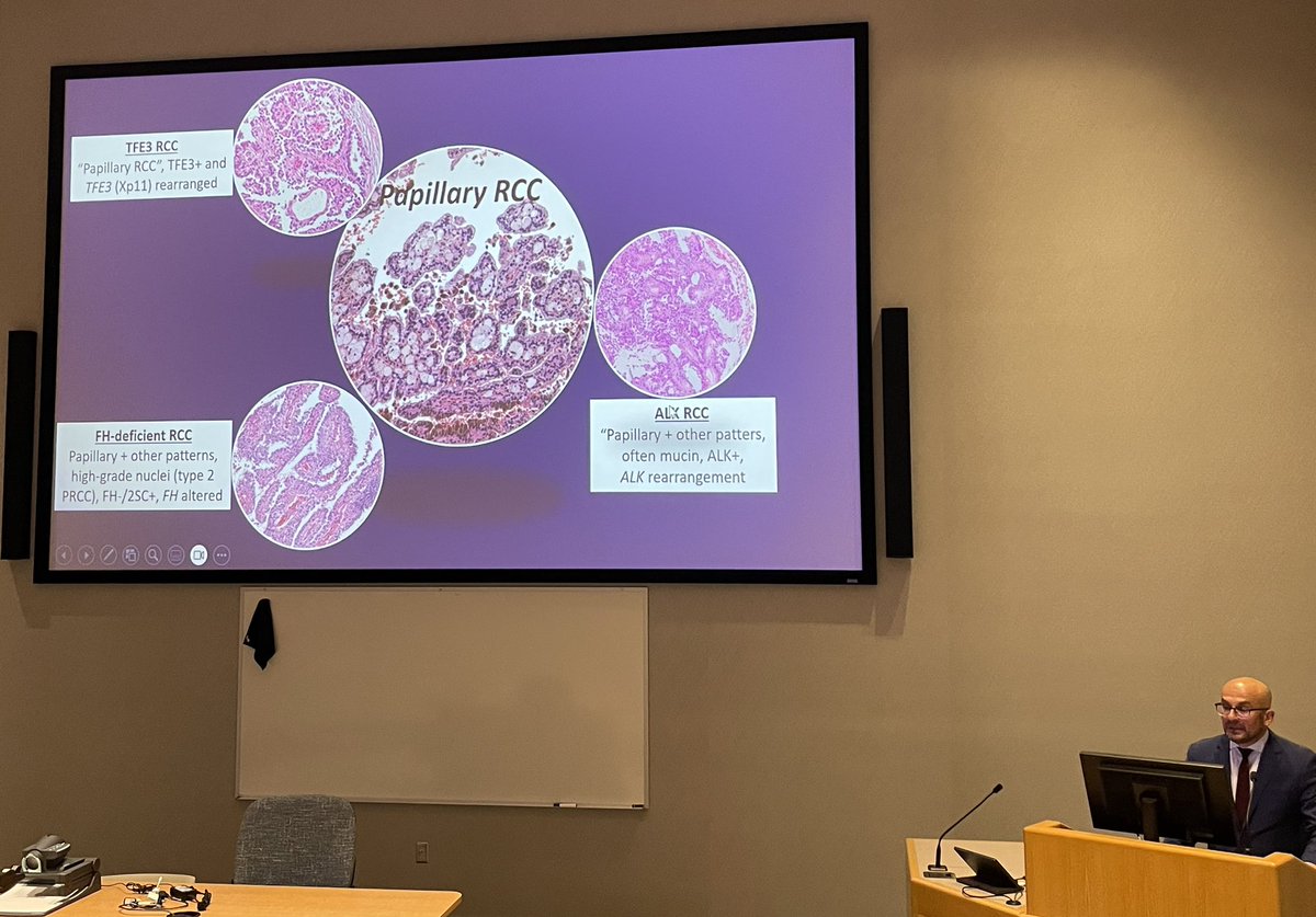 Jennifer Boland, MD (@jenniferboland7) on Twitter photo <a href="/MayoClinicPath/">Mayo Clinic Pathology</a> AP Grand rounds today by our prestigious visiting professor, Dr. Kiril Trpkov, providing a terrific update on renal cell carcinoma <a href="/Shounak_Gupta/">Sounak Gupta</a> @johncheville <a href="/RDWhaleyMD/">Rumeal D. Whaley, MD</a> <a href="/REjimenezMD/">Rafael E. Jimenez MD</a> <a href="/MayoClinicPath/">Mayo Clinic Pathology</a> AP Grand rounds today by our prestigious visiting professor, Dr. Kiril Trpkov, providing a terrific update on renal cell carcinoma <a href="/Shounak_Gupta/">Sounak Gupta</a> @johncheville <a href="/RDWhaleyMD/">Rumeal D. Whaley, MD</a> <a href="/REjimenezMD/">Rafael E. Jimenez MD</a>