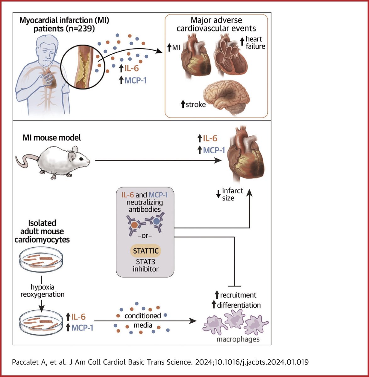 JACC Journals (@jaccjournals) on Twitter photo In a post-MI mouse model, inhibiting the IL-6/MCP-1/STAT3 axis at reperfusion onset reduces infarct size, highlighting potentially deleterious role of anti-inflammatory macrophages.
Read the new #JACCBTS study by Drs. <a href="/alexPaccalet/">Paccalet Alexandre</a>, @crola_da et al here: bit.ly/3KtYkeR In a post-MI mouse model, inhibiting the IL-6/MCP-1/STAT3 axis at reperfusion onset reduces infarct size, highlighting potentially deleterious role of anti-inflammatory macrophages.
Read the new #JACCBTS study by Drs. <a href="/alexPaccalet/">Paccalet Alexandre</a>, @crola_da et al here: bit.ly/3KtYkeR