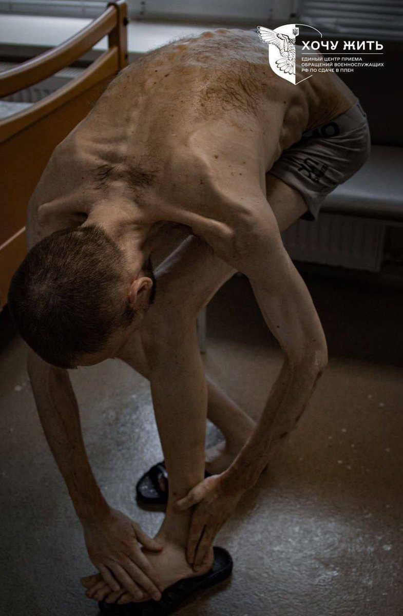 IAPonomarenko's tweet photo. The year is 2024.

And this is what happens in Europe in our time. 

Roman Horilyk, a Ukrainian serviceman with the National Guards, was taken prisoner at the Chornobyl Nuclear Power Plant, and he has spent over two years in Russian captivity.

This is his condition as he gets back home to Ukraine following the latest prisoner swap.

History repeats itself and cries for its lessons to be learned.