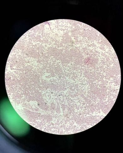 shellworkstech's tweet image. Microbes shape the world.

This microscope photo from our lab shows millions of microbes used to create our compostable material, Vivomer. It highlights their immense impact, even though they&apos;re invisible to the naked eye. 🦠🔬