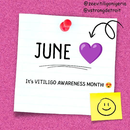 zeevitiligo's tweet photo. #vitiligo #vitiligoawarenessjourney https://t.co/qZ392s8yWa