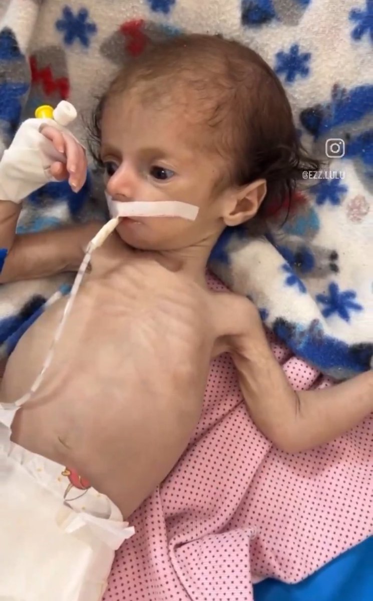 Forced starvation in Gaza is an act of genocide.