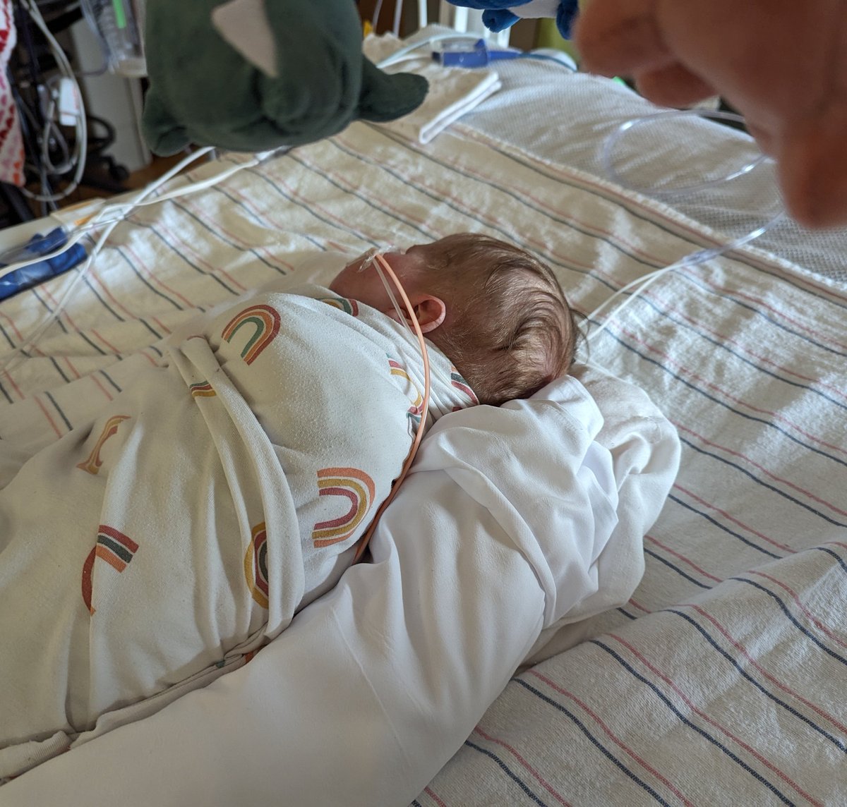 mark_joubert's tweet photo. Happy six months Gus! Hard to believe we're halfway through his first year. We've been through so much together. God has been kind. Gus is doing okay and remains stable. His kidneys still aren't doing great, but we're working to increase dialysis passes. He's a little more uncomfortable because of that, but he's making progress. The goal is to get his fluid balance more consistent and stable and transition to a cycler. 

Keep praying with us, friends. Thank you so much!