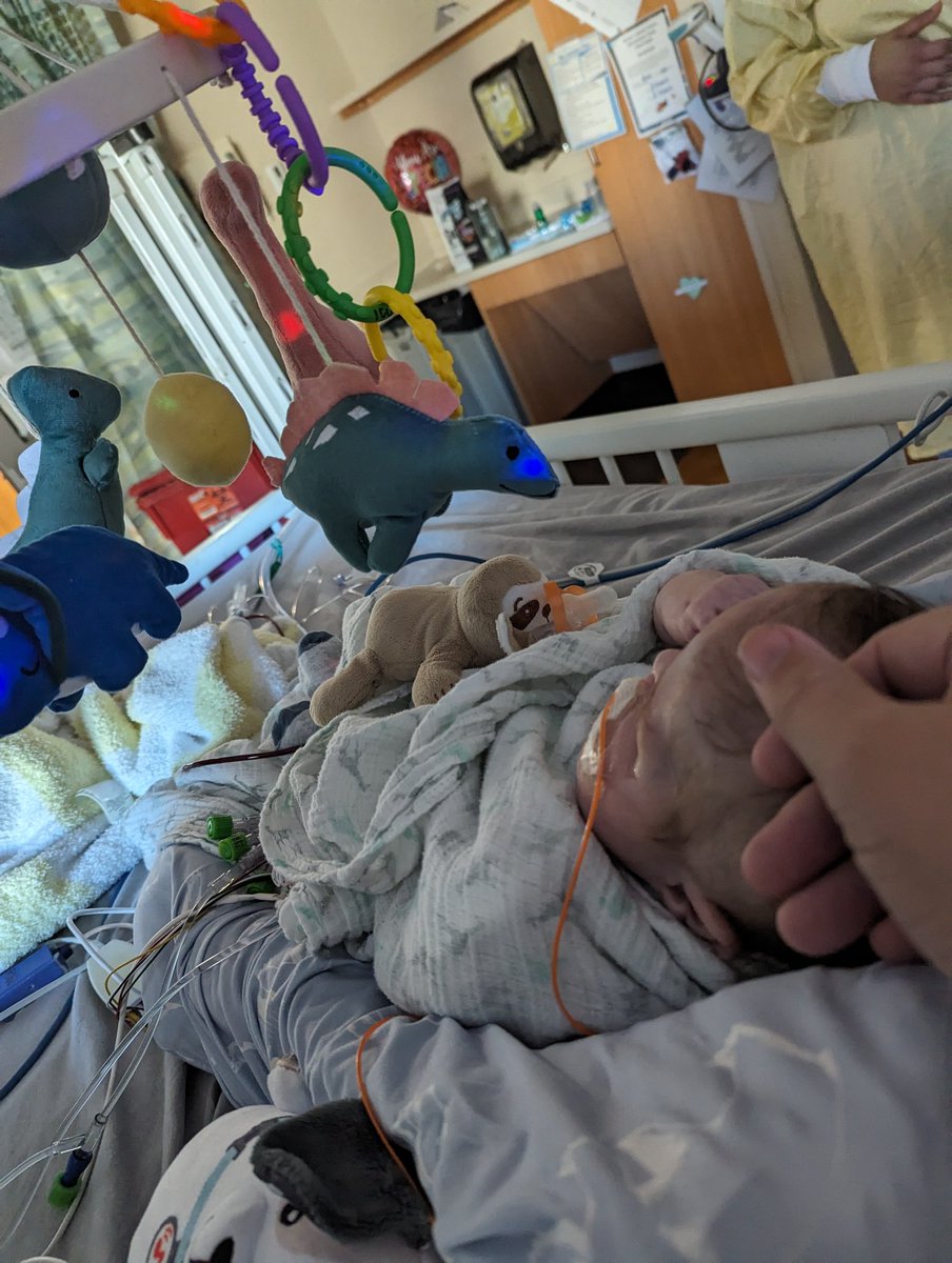mark_joubert's tweet photo. Happy six months Gus! Hard to believe we're halfway through his first year. We've been through so much together. God has been kind. Gus is doing okay and remains stable. His kidneys still aren't doing great, but we're working to increase dialysis passes. He's a little more uncomfortable because of that, but he's making progress. The goal is to get his fluid balance more consistent and stable and transition to a cycler. 

Keep praying with us, friends. Thank you so much!