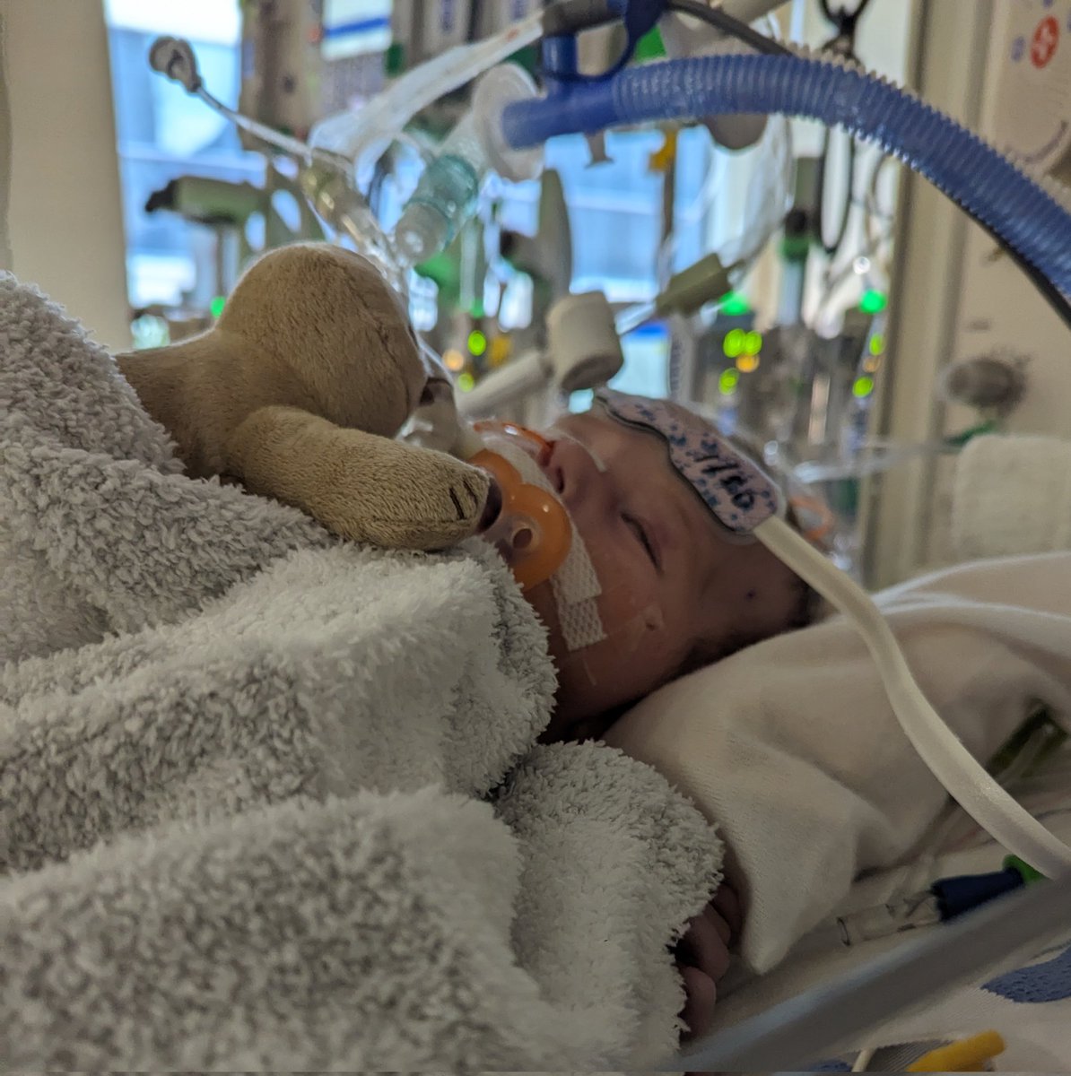 mark_joubert's tweet photo. Happy six months Gus! Hard to believe we're halfway through his first year. We've been through so much together. God has been kind. Gus is doing okay and remains stable. His kidneys still aren't doing great, but we're working to increase dialysis passes. He's a little more uncomfortable because of that, but he's making progress. The goal is to get his fluid balance more consistent and stable and transition to a cycler. 

Keep praying with us, friends. Thank you so much!