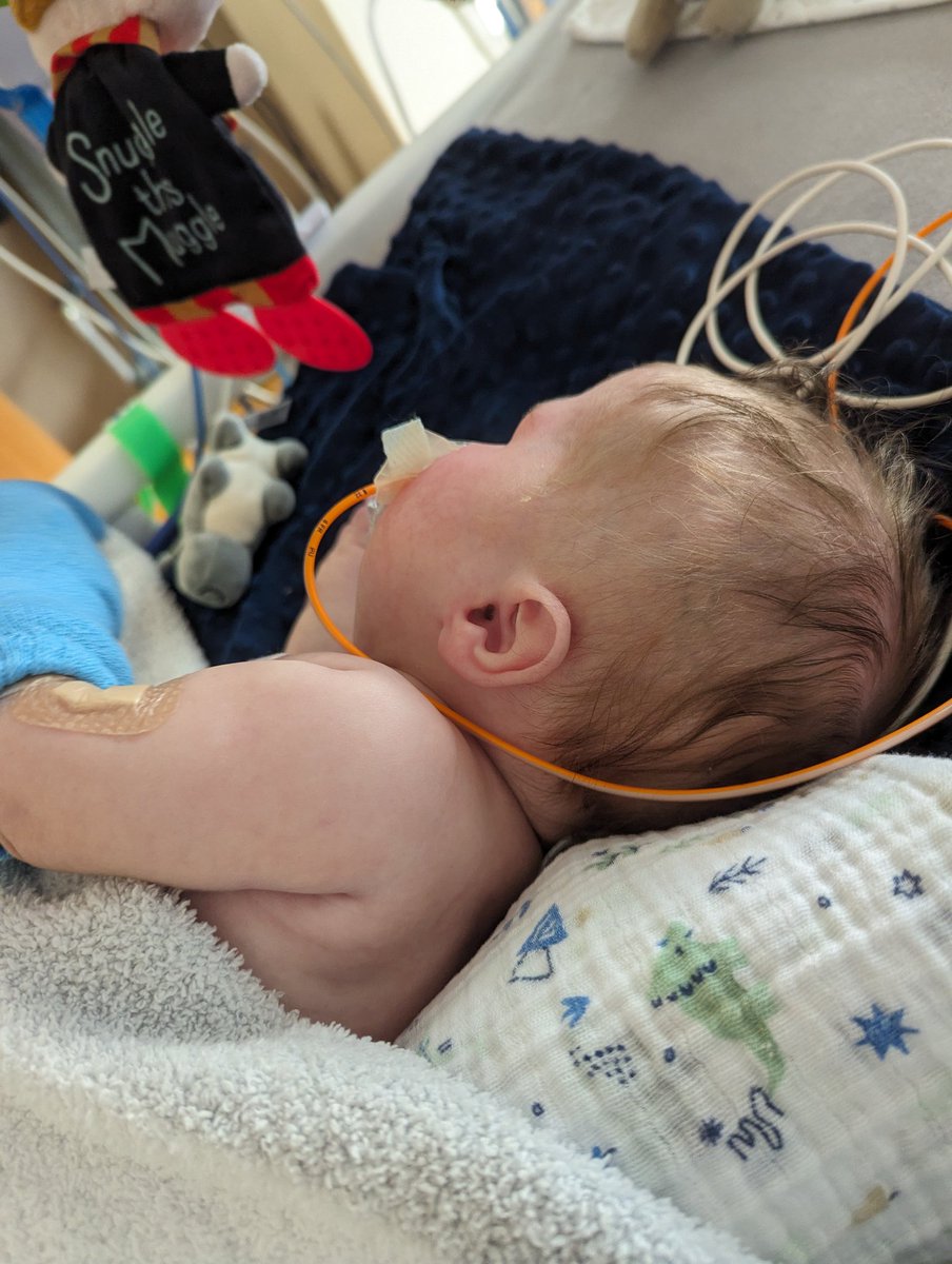mark_joubert's tweet photo. Happy six months Gus! Hard to believe we're halfway through his first year. We've been through so much together. God has been kind. Gus is doing okay and remains stable. His kidneys still aren't doing great, but we're working to increase dialysis passes. He's a little more uncomfortable because of that, but he's making progress. The goal is to get his fluid balance more consistent and stable and transition to a cycler. 

Keep praying with us, friends. Thank you so much!