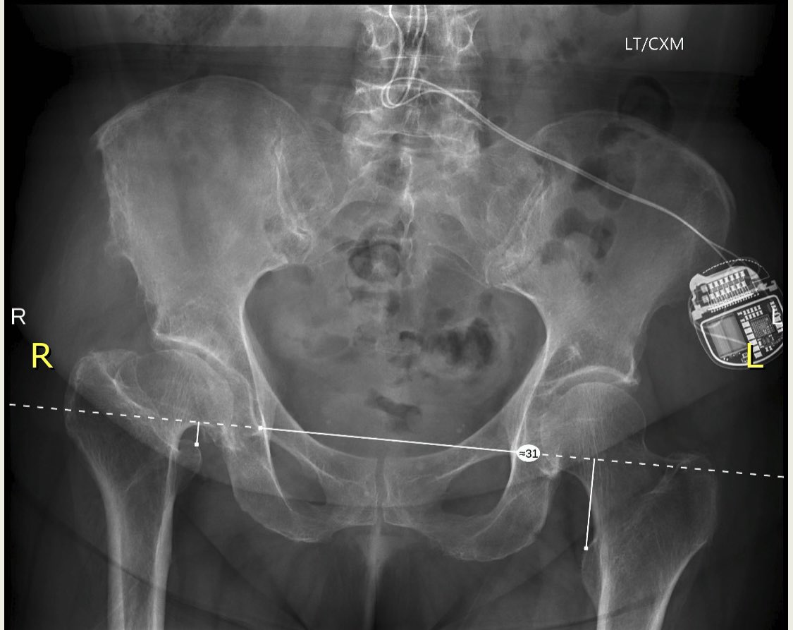 Nicolas S. Piuzzi, MD tweet media