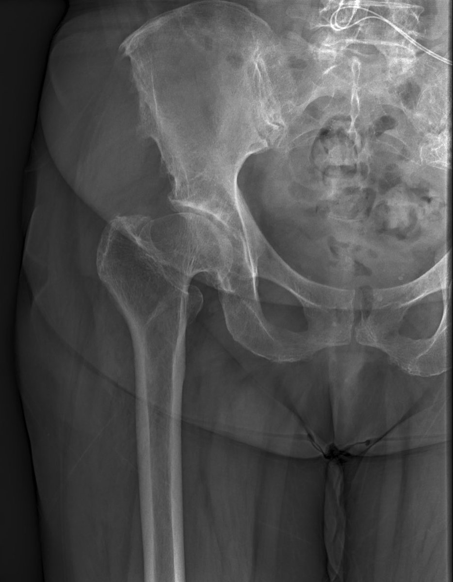 Nicolas S. Piuzzi, MD tweet media