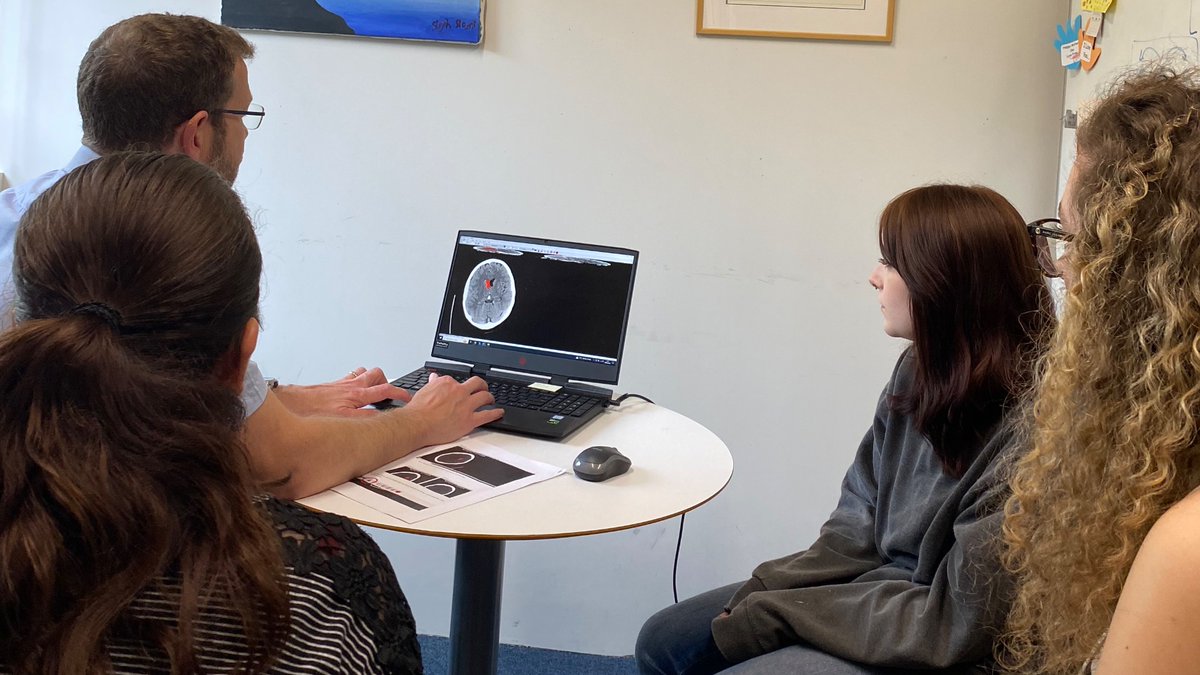 It’s always fantastic to have Dr Kneale Metcalf with us <a href="/UEANeuroLab/">Neurolab</a> to advance our stroke research. We are very lucky to have him support our lesion mapping studies.