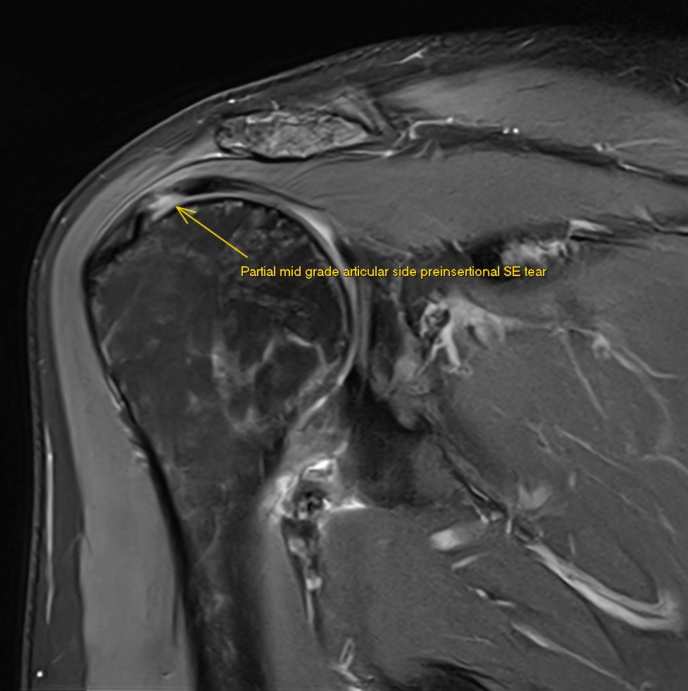 JuanMiranda tweet media