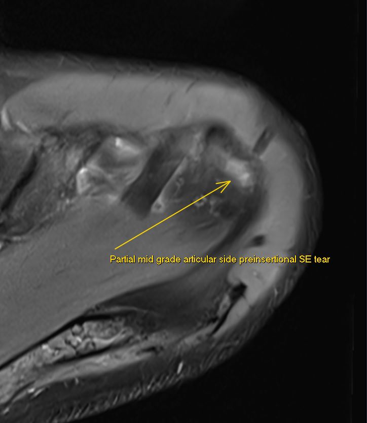 JuanMiranda tweet media