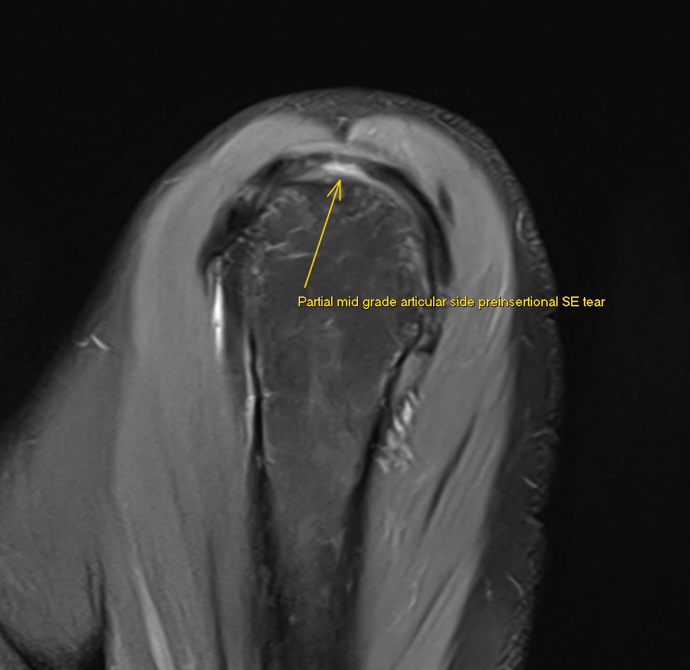 JuanMiranda tweet media