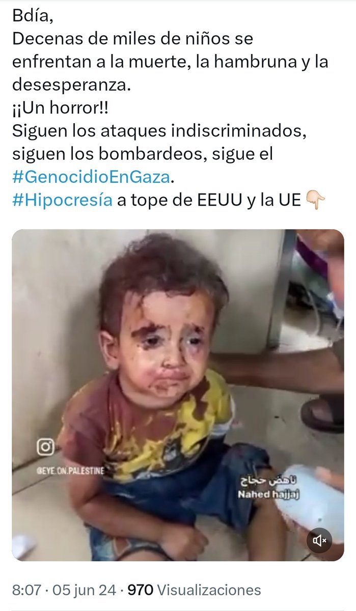 Julio_Rodr_'s tweet photo. A "X" no le gustan los "Bdías" que mencionan el horroroso #GenocidioEnGaza.
Hoy, ha vuelto a borrar el post. 
Pues, insisto. Es un #genocidio de libro y hay mucha, mucha #hipocresía 👇🏻 https://t.co/VLeWDpgqSI