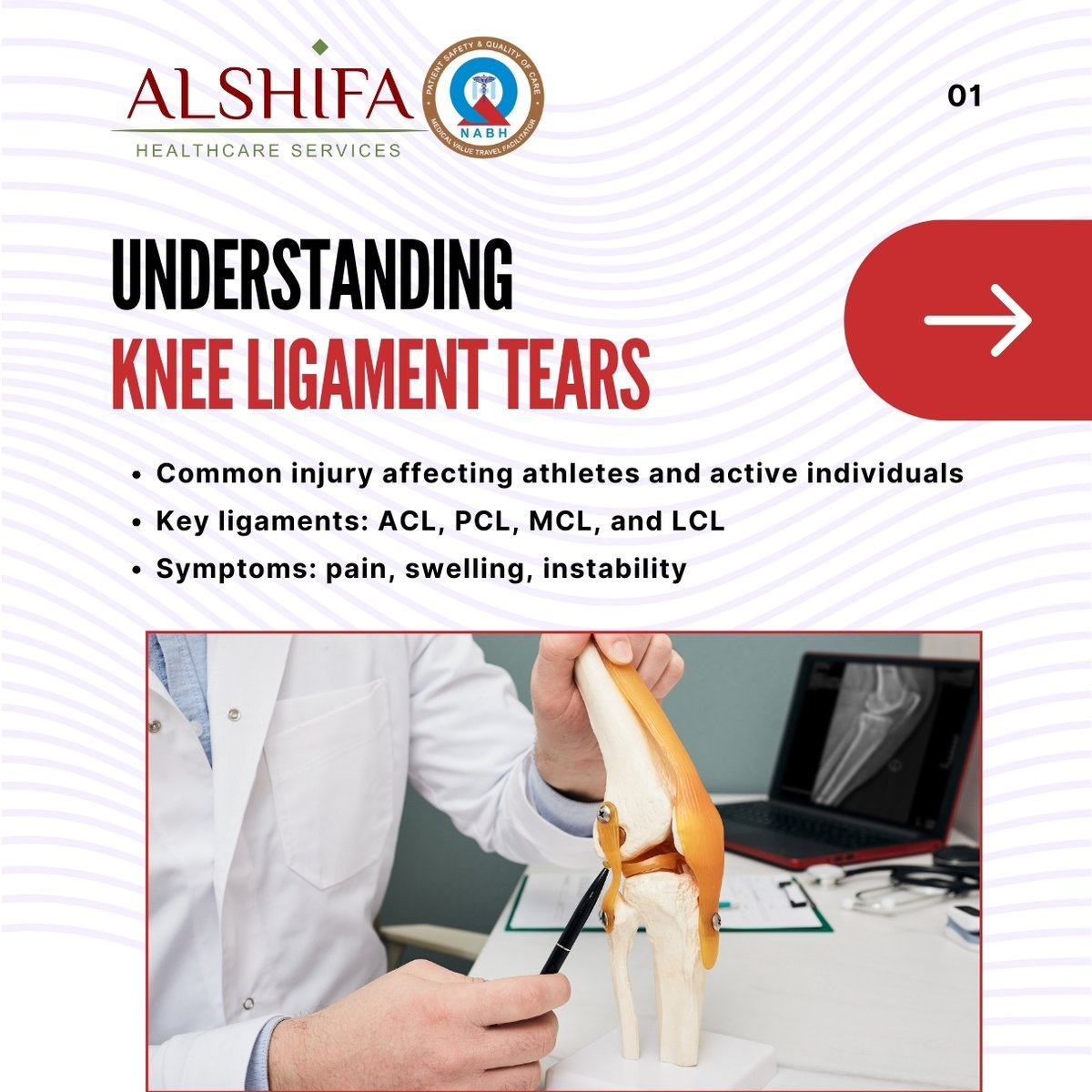 Alshifaglobal's tweet photo. #kneeligamenttear treatment involves rest, ice, compression, elevation, physical therapy, bracing, and sometimes surgery. Recovery focuses on restoring strength, stability, and mobility. 

#kneeinjury #ligamenttear #physicaltherapy #orthopedics #medicaltourism #alshifa #travel https://t.co/6ExmnmRFDI