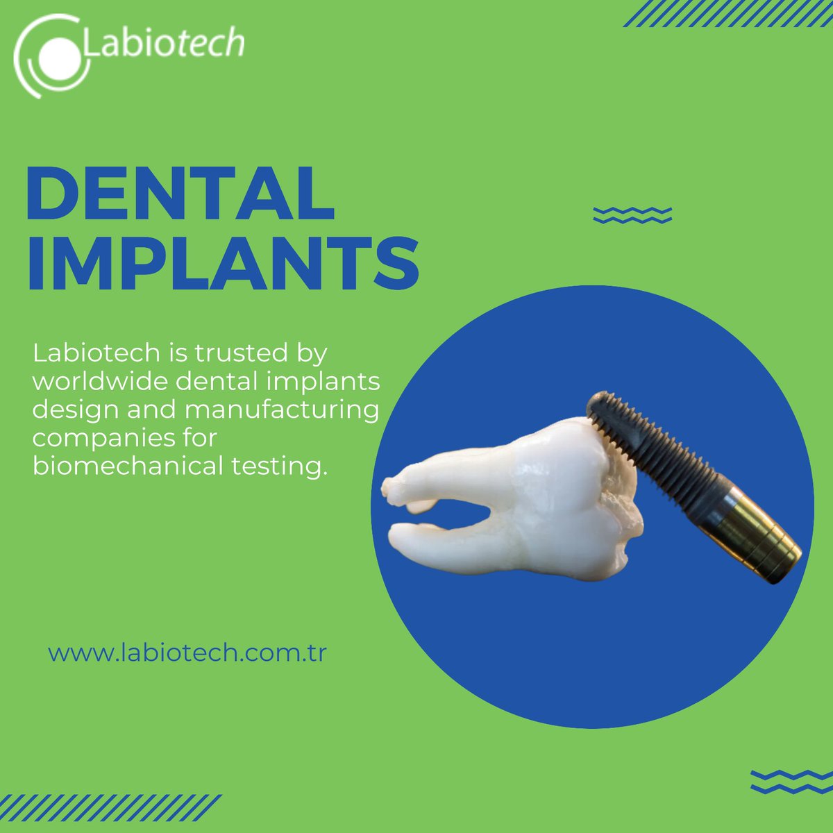 LabiotechTr's tweet photo. Labiotech tests dental implant designs for companies worldwide.

Contact us today! info@labiotech.com.tr

#Labiotech #ISO17025 #TestLab #MedicalProducts #Certification #Accredited #Biotech #MedicalDevice #QualityAssurance #ProductDevelopment #LabTesting https://t.co/oKGsShdoit