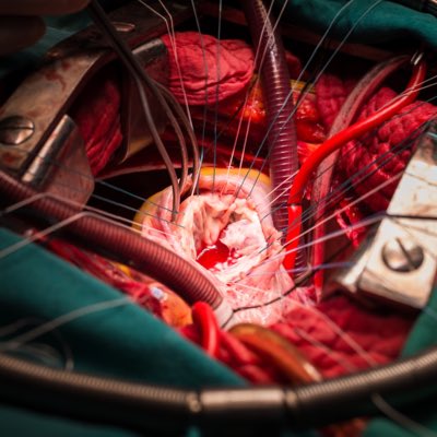 idsawyerr's tweet image. #NewProfilePic