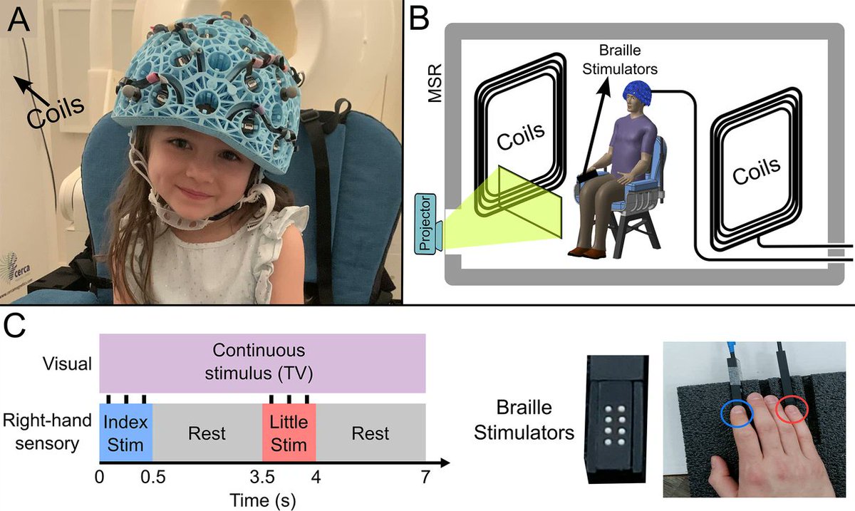 Matthew Brookes (@mattbrookesmeg) on Twitter photo Extremely happy to see this published in eLife, by the wonderful <a href="/LukasRier/">Lukas Rier</a> and <a href="/nsrhodes2/">Natalie Rhodes</a> !!! It shows the neurodevelopmental trajectory of beta 'oscillations' (and bursts!!), measured using OPM-MEG <a href="/QuSpin_/">Vishal Shah</a> <a href="/CercaMagnetics/">Cerca Magnetics Limited</a> <a href="/SPMIC_UoN/">SPMIC</a> <a href="/UoN_Physics/">UoN Physics & Astronomy</a>
elifesciences.org/articles/94561 Extremely happy to see this published in eLife, by the wonderful <a href="/LukasRier/">Lukas Rier</a> and <a href="/nsrhodes2/">Natalie Rhodes</a> !!! It shows the neurodevelopmental trajectory of beta 'oscillations' (and bursts!!), measured using OPM-MEG <a href="/QuSpin_/">Vishal Shah</a> <a href="/CercaMagnetics/">Cerca Magnetics Limited</a> <a href="/SPMIC_UoN/">SPMIC</a> <a href="/UoN_Physics/">UoN Physics & Astronomy</a>
elifesciences.org/articles/94561