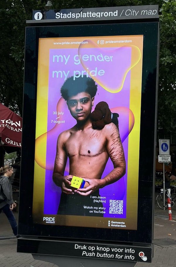 CParents04's tweet photo. #Amsterdam #genre #torsoplastie #scarifications #pride2023 https://t.co/h6yHMWIXfz
