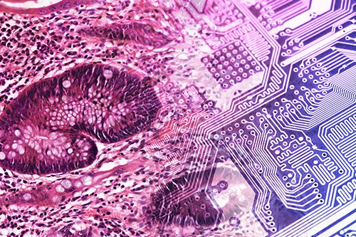 NPIC_AI's tweet photo. We are now up and running with our cluster of 10 @nvidia A40 GPUs! That's 3 PetaFLOPS of AI processing power 🦾 Massive thanks to @Exponential_e for the hard work in getting it up and running! #digitalpathology #ai #deeplearning https://t.co/IVU6ISa5rn