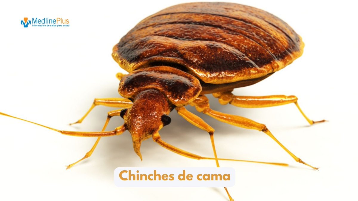 MedlinePlusEsp's tweet image. Las chinches de cama pican y se alimentan de sangre. Para prevenirlas en tu hogar:

➡️ Revisa los muebles de segunda mano  
➡️ Usa una cubierta protectora que recubra colchones y somieres
➡️ Reduce el desorden en la casa

Más aquí ow.ly/FavY50S8mc2 #BedBugAwarenessWeek