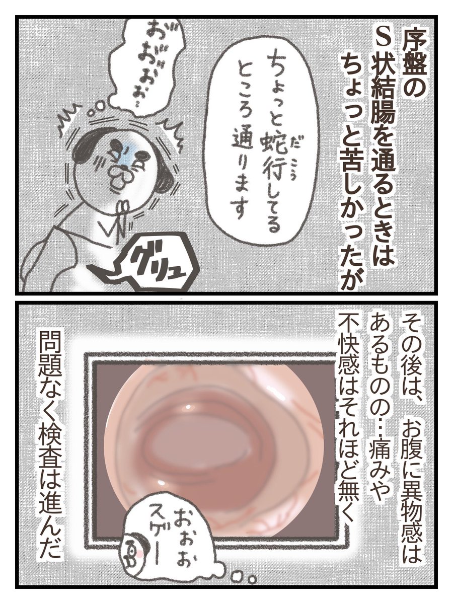 下血して内視鏡検査する話②
(4/6) 