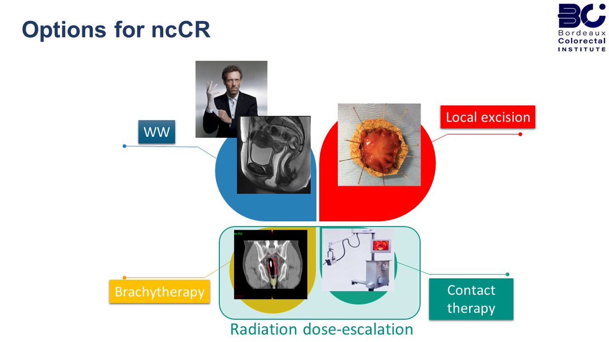 Quentin Denost (@qdenost) on Twitter photo <a href="/escp_tweets/">European Society of Coloproctology</a> #Masterclass in Austria 🇦🇹 #rectal #cancer very well organized by <a href="/FelixAigner2/">Felix Aigner</a>
👉#TNT which regimen - which goal ?
👉#Deescalation How to do ?
👉#overtretament of early cancer
👉#ncCR How to manage ?
👉 #ICG
<a href="/RoelHompes/">Roel Hompes</a> <a href="/JurriaanTuynman/">Jurriaan Tuynman</a> <a href="/DaniloMisko/">Danilo Miskovic</a> <a href="/YouESCP/">Young ESCP</a> <a href="/escp_tweets/">European Society of Coloproctology</a> #Masterclass in Austria 🇦🇹 #rectal #cancer very well organized by <a href="/FelixAigner2/">Felix Aigner</a>
👉#TNT which regimen - which goal ?
👉#Deescalation How to do ?
👉#overtretament of early cancer
👉#ncCR How to manage ?
👉 #ICG
<a href="/RoelHompes/">Roel Hompes</a> <a href="/JurriaanTuynman/">Jurriaan Tuynman</a> <a href="/DaniloMisko/">Danilo Miskovic</a> <a href="/YouESCP/">Young ESCP</a>