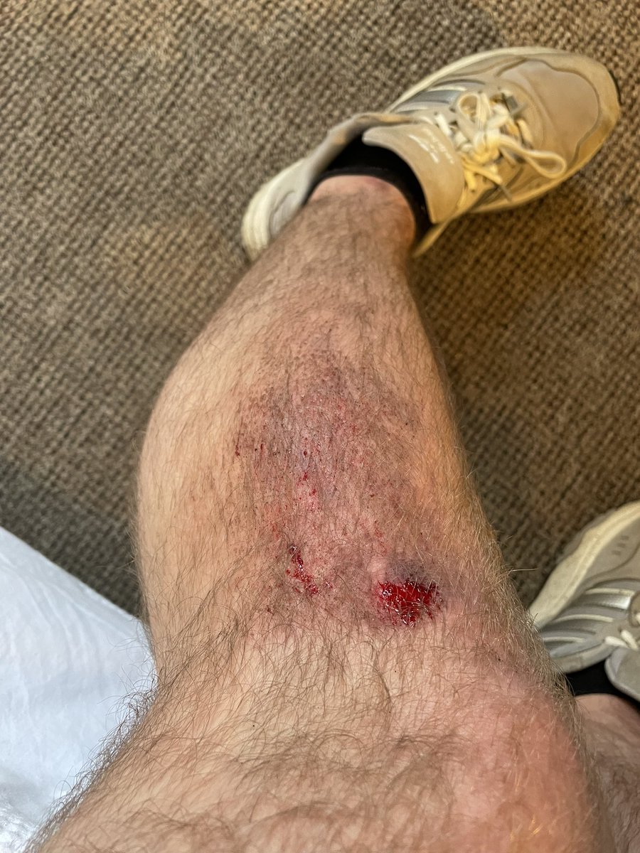 oscarofward's tweet photo. @SheffCouncil fancy fixing our pavements? Never seen a British city with such poor quality roads and walkways. https://t.co/HCH4up7t1R