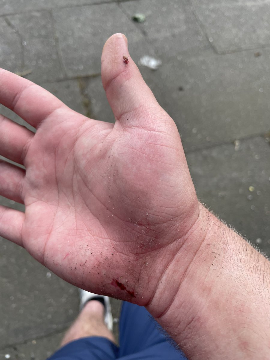 oscarofward's tweet photo. @SheffCouncil fancy fixing our pavements? Never seen a British city with such poor quality roads and walkways. https://t.co/HCH4up7t1R