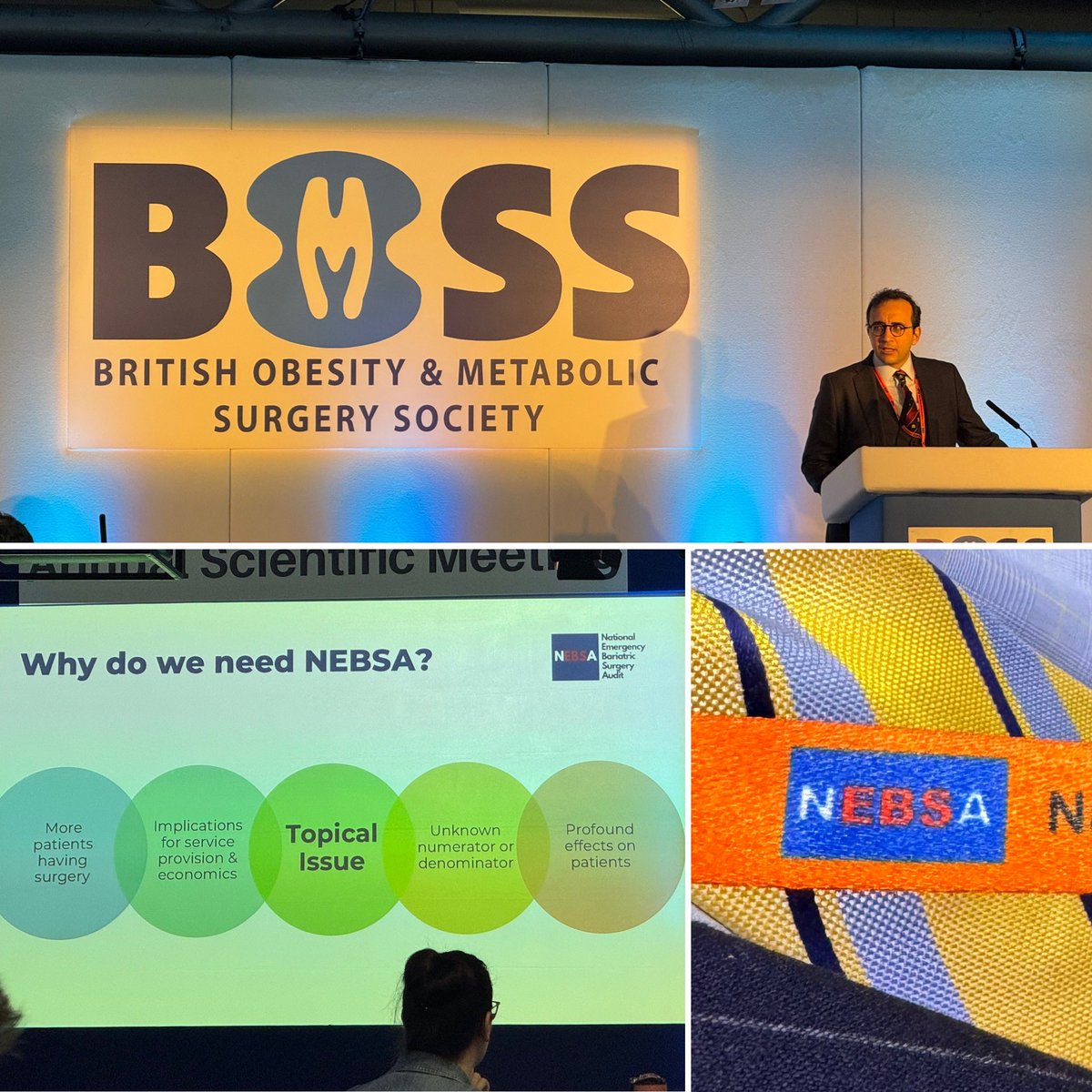 <a href="/MohamedKAly/">Mohamed Aly</a> talking about NEBSA and why we need to collect data in UK about emergency surgery for patients undergoing Bariatric surgery (both in UK and elsewhere). 
All units should register and submit data. 
<a href="/bariatricBOMSS/">BOMSS</a> #bomss2024 #nebsa