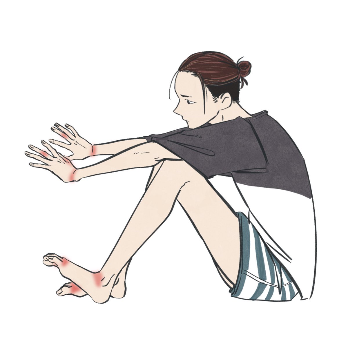 赤いとこ慢性的な腱鞘炎…ウケる🤣