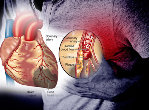 SeriesScience's tweet photo. Continuation of Beta Blockers in Patients on Inotrope Therapy: A Counterintuitive Dilemma
#heart #cardio #heartfailure #bloodpressure #cholesterol #ADHF #BMI #cardiovascular #Inotrope #therapy #ResearchPapers #seriesscience 

Read complete #article here:
https://t.co/ILTDGXJV3v https://t.co/nLoaRUzGhr