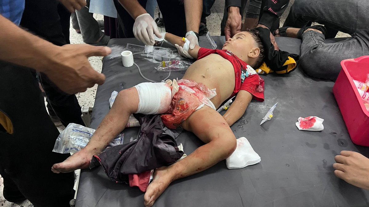 RamAbdu's tweet photo. Breaking: An Israeli drone bombed a group of children in the Zaytoun neighborhood east of Gaza, injuring at least 30 people, most of them children. https://t.co/1E94mCTsaS