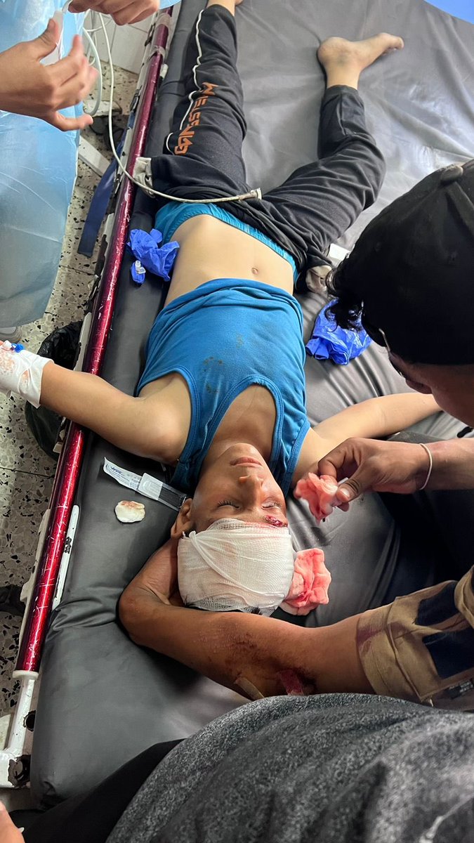 RamAbdu's tweet photo. Breaking: An Israeli drone bombed a group of children in the Zaytoun neighborhood east of Gaza, injuring at least 30 people, most of them children. https://t.co/1E94mCTsaS