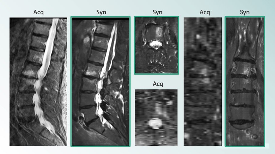 lofiMRI's tweet photo. 🚨 Paid internship opportunity! 🚨
Please share🙏, DM me if interested

Project: DL based MR image synthesis 🧲

Details
- Paid full-time internship (40 hr/wk)
- Summer or Fall, flexible start/stop dates
- 2-3 month commitment
- Fully remote

Requires: DL &amp; research experience🧑‍🔬 https://t.co/0GWycR3mn8