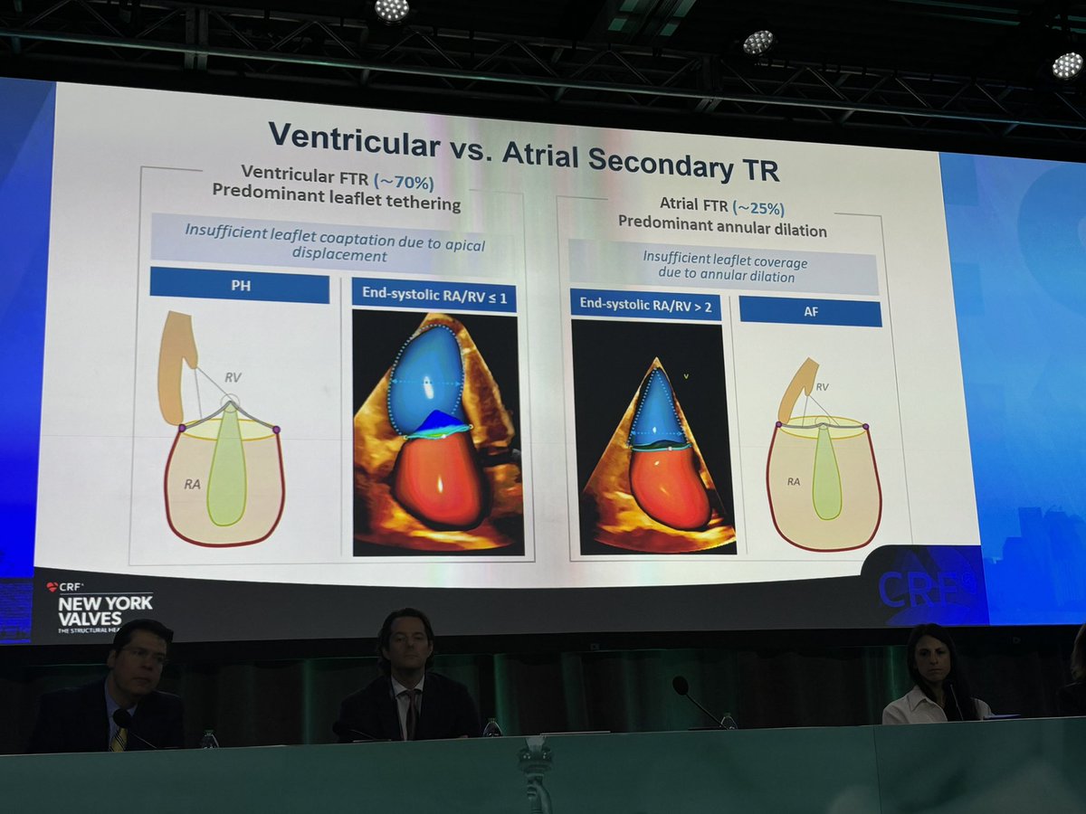 JGrapsa's tweet image. Wonderful lecture by @FabienPraz on the current knowledge on #tricuspid regurgitation #NYvalves2024 @crfheart @MadalinaGarbi @JoaoLCavalcante @EZancanaroMD