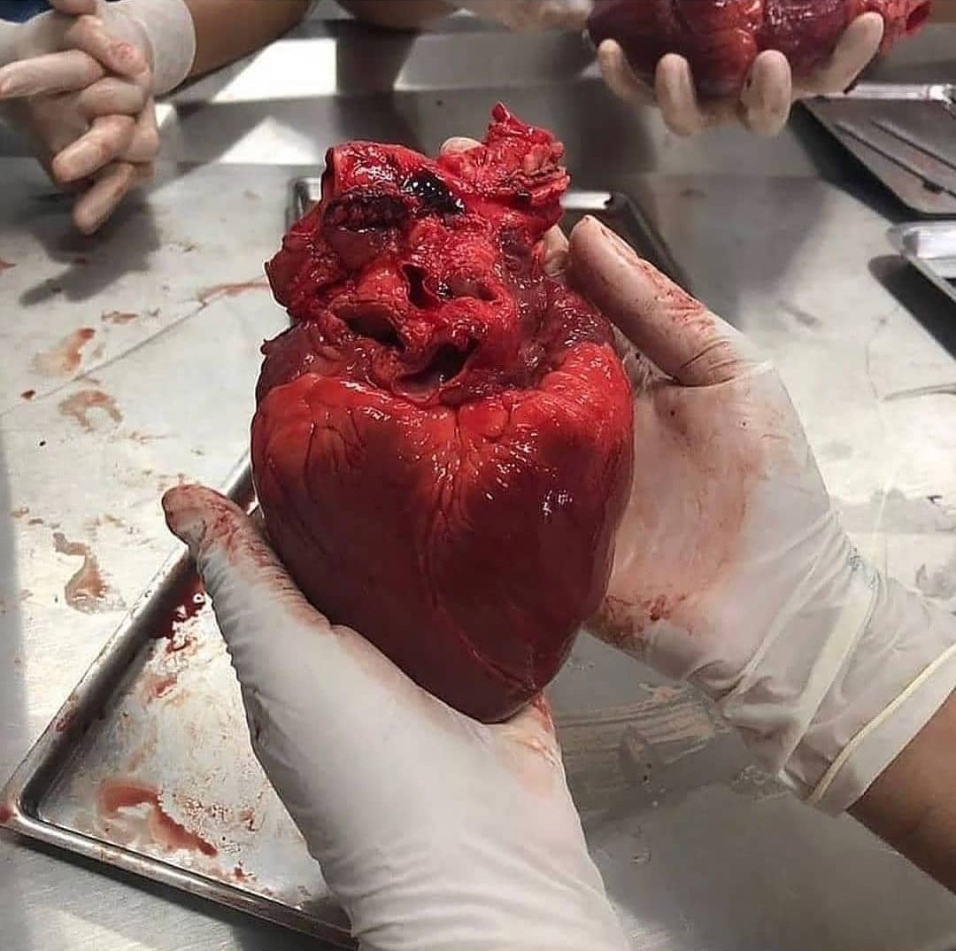 imsharmaaaa's tweet photo. Human heart 🫀 https://t.co/VxYDTeLLKI