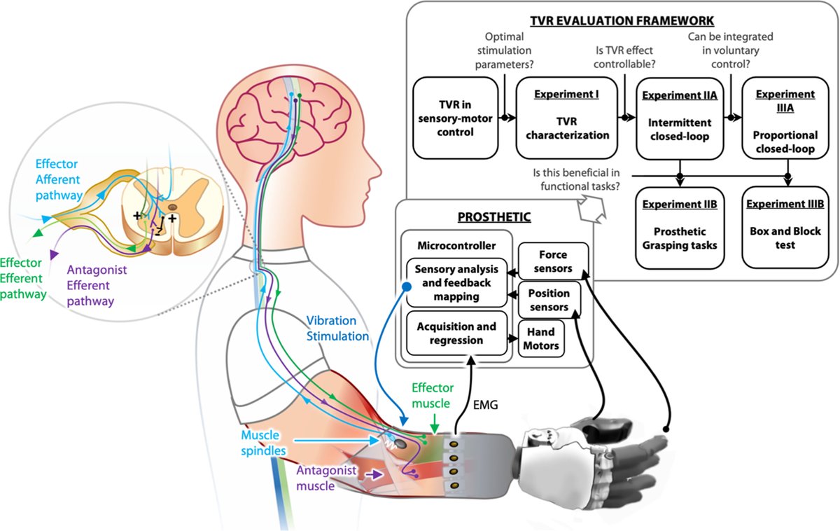 Closed-loop #tendon vibration in #amputee volunteers improves their control of hand #prosthesis, according to a new Science #Robotics study. scim.ag/7cW