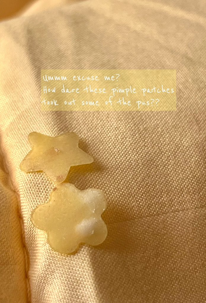 shiidasham's tweet photo. Omg. This is disgusting but I just have to show u the after. Yang banyak2 tu I apply hari lain. They sucked all the pus I had on my face. 

Nasib baik @tatagaltier @aushmilby dah start jual their pimple patch!!  But in all seriousness, u should get one! https://t.co/3ko250DFCq