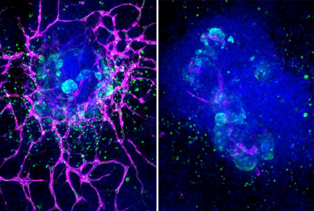Beno Freedman (@benofreedman) on Twitter photo Our new paper <a href="/CellReports/">Cell Reports</a> shows interferon-γ is bad news for kidney blood vessels in #organoids & patients. A missing piece of the #APOL1 puzzle that might be treatable. Led by postdoc Ben Juliar, et all-star collaborators
cell.com/cell-reports/f…
News: newsroom.uw.edu/news-releases/… Our new paper <a href="/CellReports/">Cell Reports</a> shows interferon-γ is bad news for kidney blood vessels in #organoids & patients. A missing piece of the #APOL1 puzzle that might be treatable. Led by postdoc Ben Juliar, et all-star collaborators
cell.com/cell-reports/f…
News: newsroom.uw.edu/news-releases/…