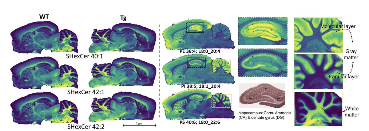 ShenTong_ST's tweet photo. Special in rat model to elucidate lipids’ role in Alzheimer’s disease using MALDI MS imaging with MS/MS confirmation. Sulfatides were lower in AD transgenic rat brain (pons and medulla) compared to wildtype. #ASMS2024 come chat with me at WP 547 https://t.co/CzQqiOvSZ6