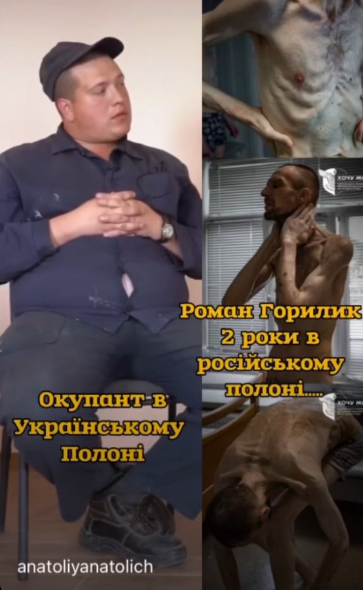 Russian soldier in Ukrainian captivity 

VS

Ukrainian soldier in Russian captivity 

It’s real hell.